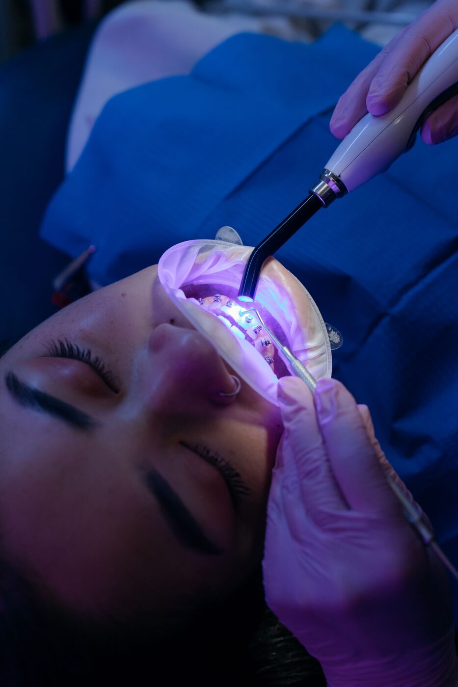 Orthodontic procedure