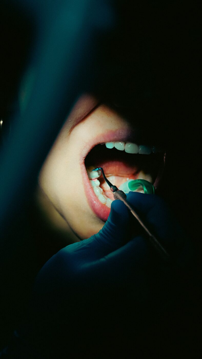 Dental scaling procedure